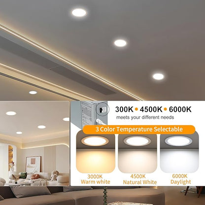 6 Pack 8 Inch LED Recessed Lighting with Junction Box Ultra-Thin, 3000K/4500K/6000K Selectable, 8" Dimmable Canless LED Downlight, 1800LM CRI80 High Brightness 5%-100% Recessed Light…