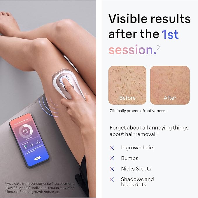 Braun Smart IPL, Skin i·Expert Pro 7, VOGUE's Best Hair Removal Device, IPL Hair Removal for Women and Men, Permanent Laser Hair Reduction At-Home, World's 1st Smart App, 4 Heads, IPL7387
