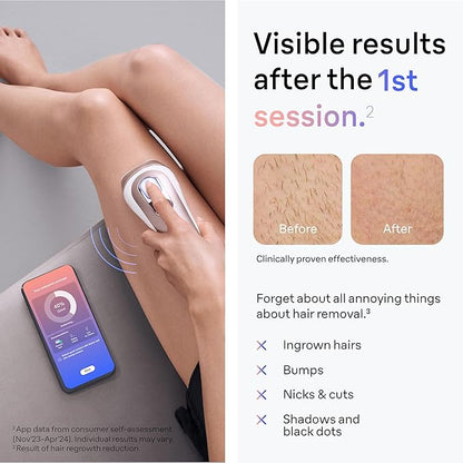 Braun Smart IPL, Skin i·Expert Pro 7, VOGUE's Best Hair Removal Device, IPL Hair Removal for Women and Men, Permanent Laser Hair Reduction At-Home, World's 1st Smart App, 4 Heads, IPL7387
