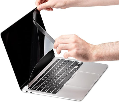 StarTech.com Laptop Privacy Screen for 15 inch MacBook Pro & MacBook Air - Magnetic Removable Security Filter - Blue Light Reducing Screen Protector 16:10 - Matte/Glossy - +/-30 Degree (PRIVSCNMAC15)